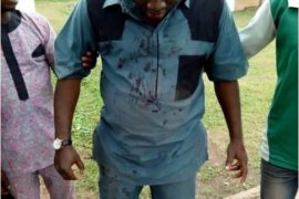 Osun Rerun: PDP Youth Leader Seriously Beaten By Thugs (Photos)