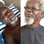 Nollywood Actor, Victor Olaotan Set To Lose His Two Legs Via Amputation, Cries Out For Help