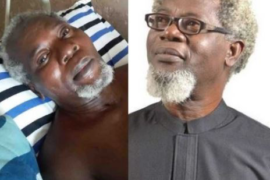 Nollywood Actor, Victor Olaotan Set To Lose His Two Legs Via Amputation, Cries Out For Help