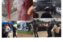 #RevolutionNow : Police Shoots, Harras, Arrests Protesters (Video)