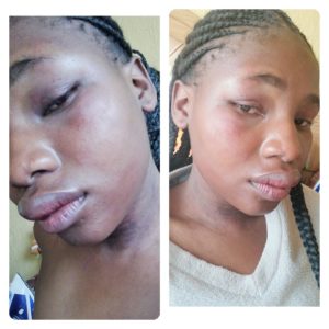 Lady Raped By Her Close Friend, Advises Other Ladies