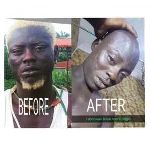 Check Out The New Look Of Kingtbakhoc After The Police Released Him (Photos)