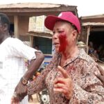 Many Injured as Violence Erupts at APC Ward Congress in Oluyole
