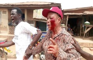 Many Injured as Violence Erupts at APC Ward Congress in Oluyole